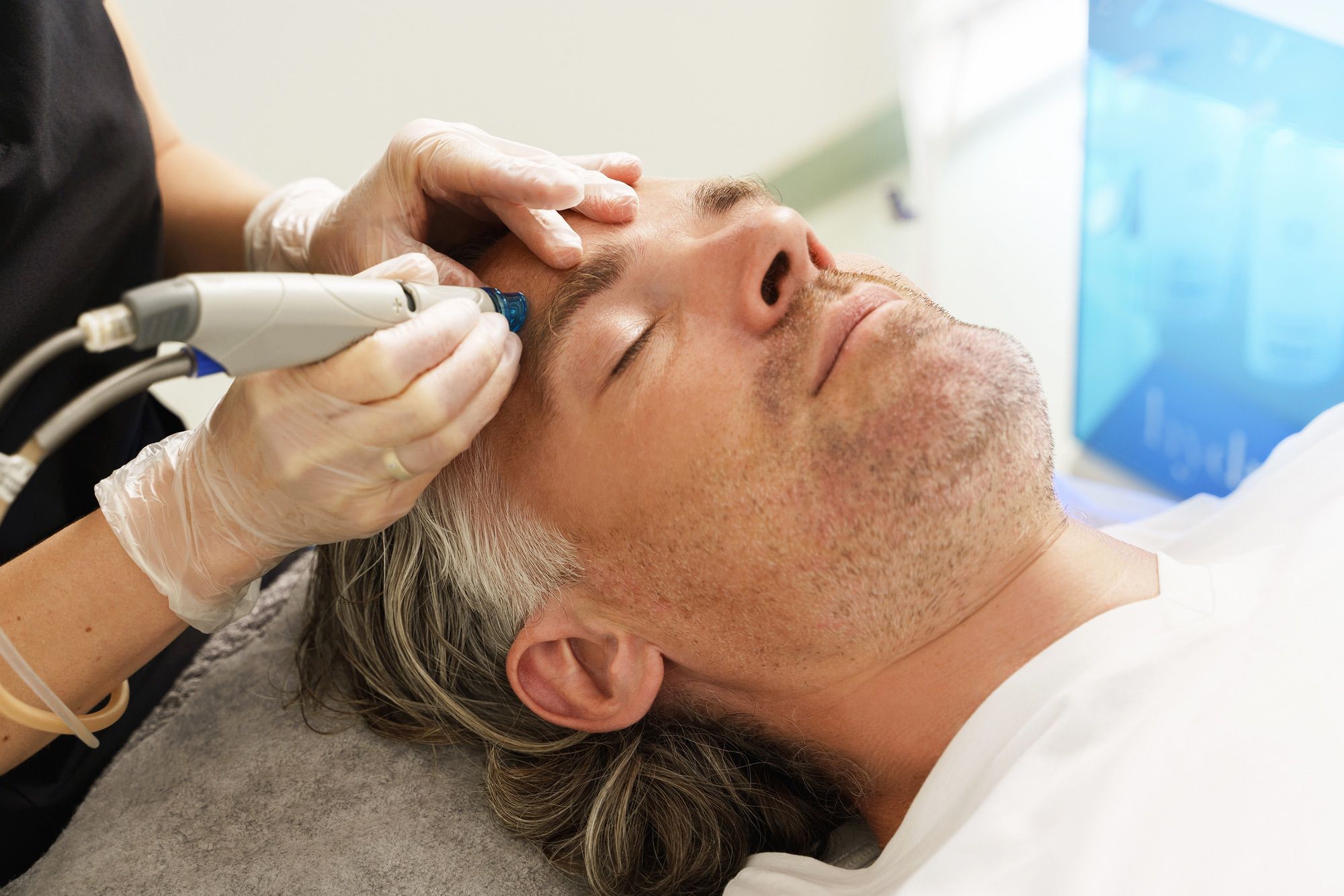 Hydrafacial San Antonio Stadia for Men treatment