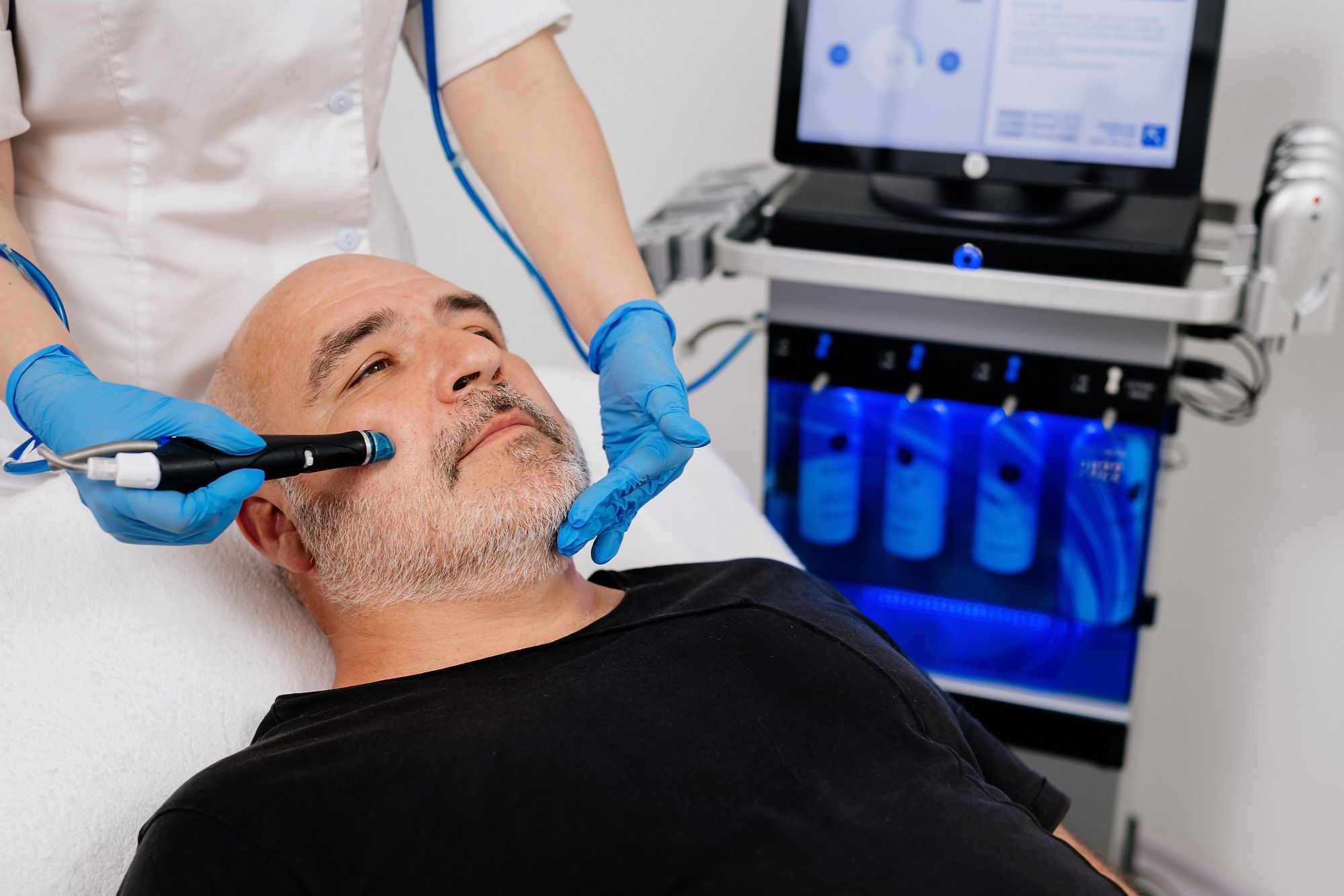 Hydrafacial San Antonio Stadia for Men treatment1