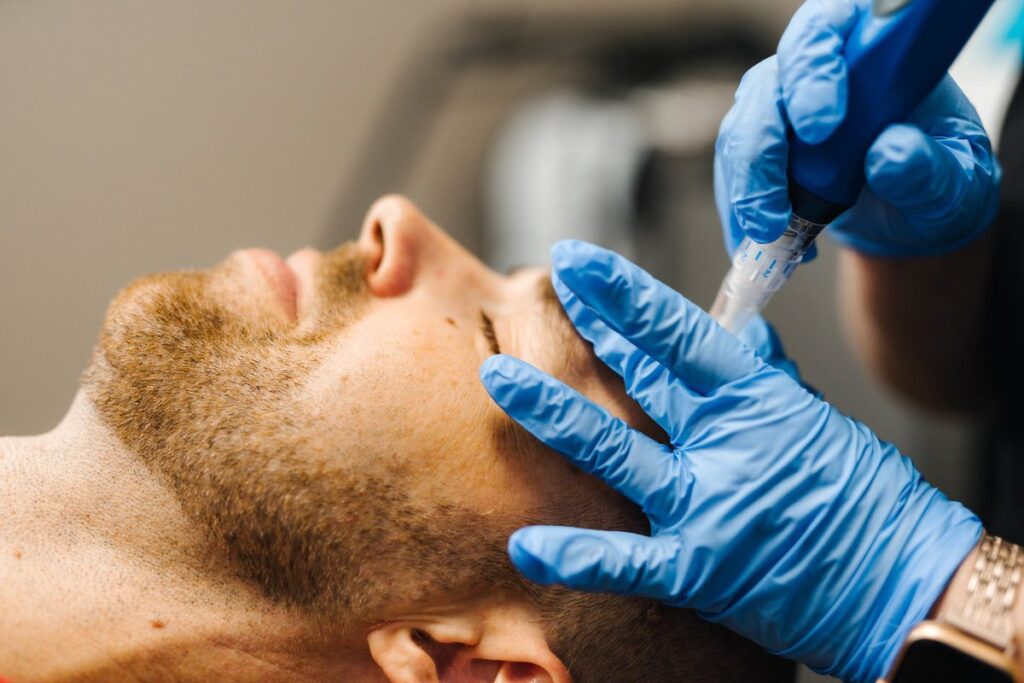 Skinpen Microneedling San Antonio Stadia for Men header