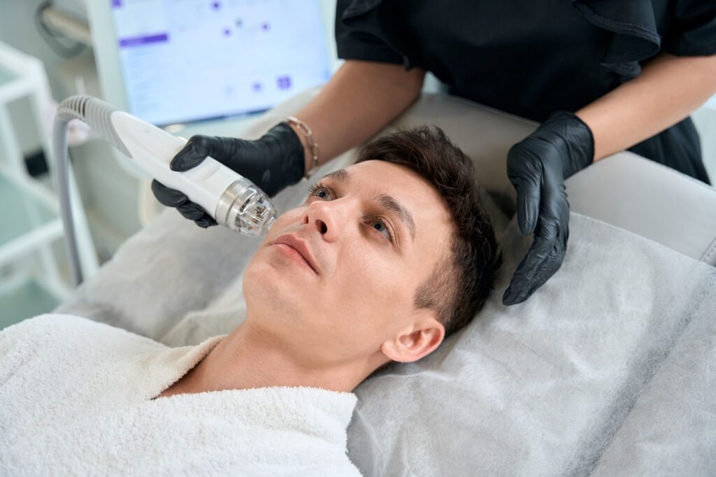 male face rf microneedling patient at Stadia for Men in San Antonio